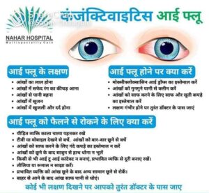 अशी घ्या डोळ्याची काळजी : Take care of your eyes 6 Take care of your eyes4